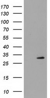HEK293T cells were transfected with the pCMV6-ENTRY control (Left lane) or pCMV6-ENTRY PYCRL (Right lane) cDNA for 48 hrs and lysed. Equivalent amounts of cell lysates (5 ug per lane) were separated by SDS-PAGE and immunoblotted with anti-PYCRL.