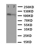 WB of TJP3 / ZO3 antibody. Lane 1: Rat Brain Tissue Lysate. Lane 2: Rat Heart Tissue Lysate.