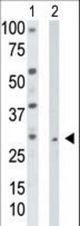 The anti-TK2 antibody is used in Western blot to detect TK2 in HepG2 cell lysate (Lane 1) and mouse liver tissue lysate (Lane 2).