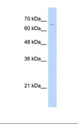 Jurkat cell lysate. Antibody concentration: 2.5 ug/ml. Gel concentration: 12%.