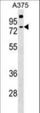 TKTL2 Antibody western blot of A375 cell line lysates (35 ug/lane). The TKTL2 antibody detected the TKTL2 protein (arrow).