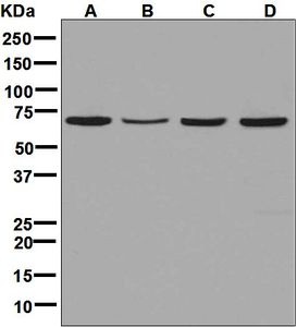 Western blot analysis on (A) Jurkat, (B) HepG2, (C) BxPC-3, and (D) MCF-7 cell lysates using anti-TKTL2 antibody.