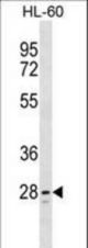 TLCD1 Antibody western blot of HL-60 cell line lysates (35 ug/lane). The TLCD1 antibody detected the TLCD1 protein (arrow).