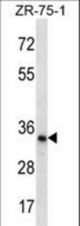 TLCD2 Antibody western blot of ZR-75-1 cell line lysates (35 ug/lane). The TLCD2 antibody detected the TLCD2 protein (arrow).