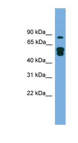 KIAA1609 antibody LS-C135451 Western blot of Transfected 293T cell lysate.