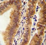 K1609 Antibody immunohistochemistry of formalin-fixed and paraffin-embedded human uterus tissue followed by peroxidase-conjugated secondary antibody and DAB staining.