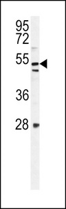 K1609 Antibody western blot of mouse NIH-3T3 cell line lysates (35 ug/lane). The K1609 antibody detected the K1609 protein (arrow).