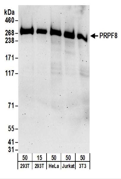 Detection of Human and Mouse PRPF8 by Western Blot. Samples: Whole cell lysate from 293T (15 and 50 ug), HeLa (50 ug), Jurkat (50 ug), and mouse NIH3T3 (50 ug) cells. Antibodies: Affinity purified rabbit anti-PRPF8 antibody used for WB at 0.1 ug/ml. Detection: Chemiluminescence with an exposure time of 3 minutes.