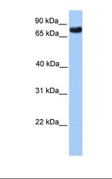 Transfected 293T cell lysate. Antibody concentration: 1.0 ug/ml. Gel concentration: 12%.