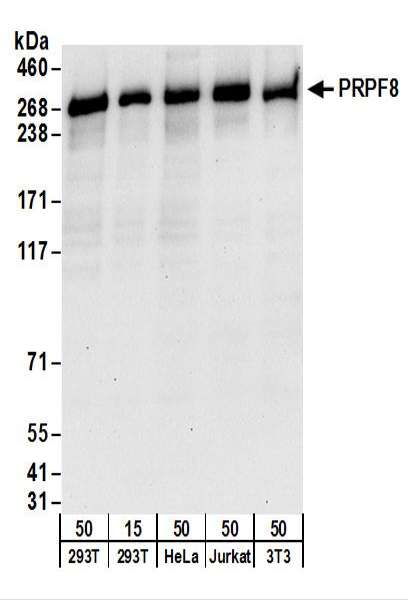 Detection of Human and Mouse PRPF8 by Western Blot. Samples: Whole cell lysate from 293T (15 and 50 ug), HeLa (50 ug), Jurkat (50 ug), and mouse NIH3T3 (50 ug) cells. Antibodies: Affinity purified rabbit anti-PRPF8 antibody used for WB at 0.1 ug/ml. Detection: Chemiluminescence with an exposure time of 30 seconds.