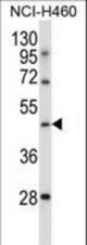 TLE6 Antibody (N-term ) western blot of NCI-H460 cell line lysates (35 ug/lane). The TLE6 antibody detected the TLE6 protein (arrow).