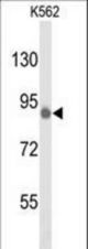Western blot of hTLK1-L687 in K562 cell line lysates (35 ug/lane). TLK1 (arrow) was detected using the purified antibody.