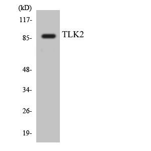 Western blot of the lysates from HeLa cells using TLK2 antibody.