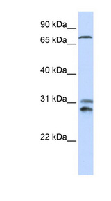 TLK2 antibody LS-C112180 Western blot of 721_B cell lysate.
