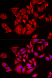 Immunofluorescence analysis of U2OS cell using TLK2 antibody. Blue: DAPI for nuclear staining.
