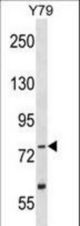 TLK2 Antibody (K155) western blot of Y79 cell line lysates (35 ug/lane). The TLK2 antibody detected the TLK2 protein (arrow).