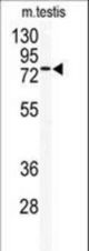 Western blot of anti-TLK2 Antibody in mouse testis tissue lysates (35 ug/lane). TLK2(arrow) was detected using the purified antibody.