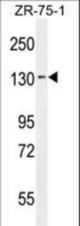 TLL1 Antibody western blot of ZR-75-1 cell line lysates (35 ug/lane). The TLL1 antibody detected the TLL1 protein (arrow).
