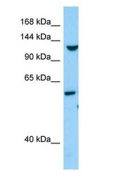 TLL1 antibody Western Blot of Fetal Heart.