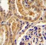 TLL2 Antibody immunohistochemistry of formalin-fixed and paraffin-embedded human kidney tissue followed by peroxidase-conjugated secondary antibody and DAB staining.