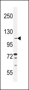 TLL2 Antibody western blot of ZR-75-1 cell line lysates (35 ug/lane). The TLL2 antibody detected the TLL2 protein (arrow).