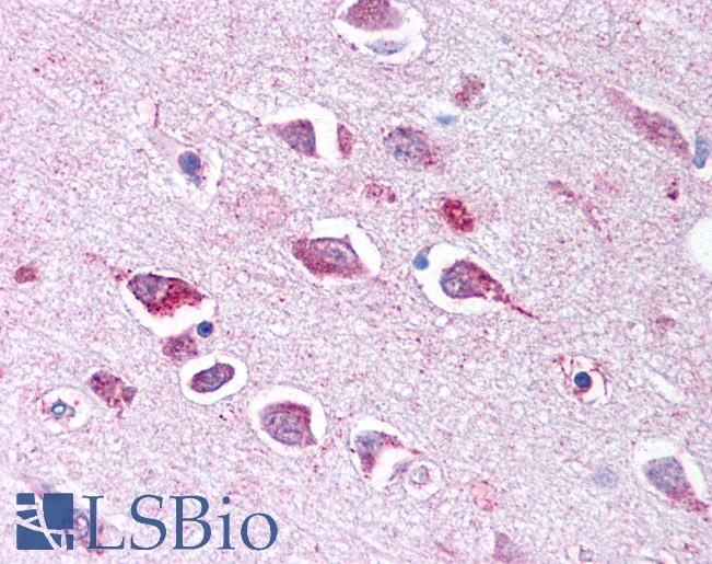 Anti-TLL2 antibody LS-A9072 IHC of human brain, neurons and glia. Immunohistochemistry of formalin-fixed, paraffin-embedded tissue after heat-induced antigen retrieval.