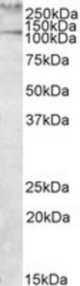 TLN1 antibody (1 ug/ml) staining of Human Peripheral Mononucleocytes lysate (35 ug protein in RIPA buffer). Primary incubation was 1 hour. Detected by chemiluminescence.