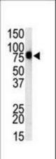 Western blot of anti-mTLR1 antibody in mouse spleen cell lysate. mTLR1 (arrow) was detected using purified antibody. Secondary HRP-anti-rabbit was used for signal visualization with chemiluminescence.