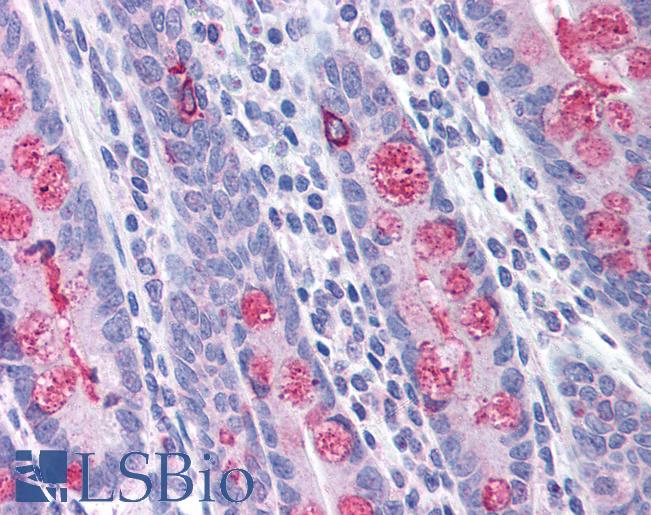 Anti-TLR1 antibody IHC of human small intestine. Immunohistochemistry of formalin-fixed, paraffin-embedded tissue after heat-induced antigen retrieval. Antibody LS-B1415 concentration 5 ug/ml.