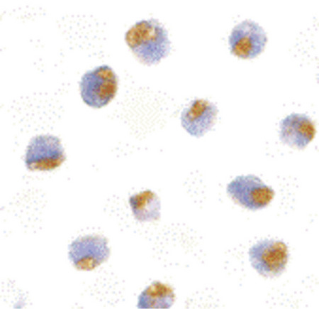 Immunocytochemistry of TLR1 in Daudi with TLR1 antibody at 10 ug/ml.
