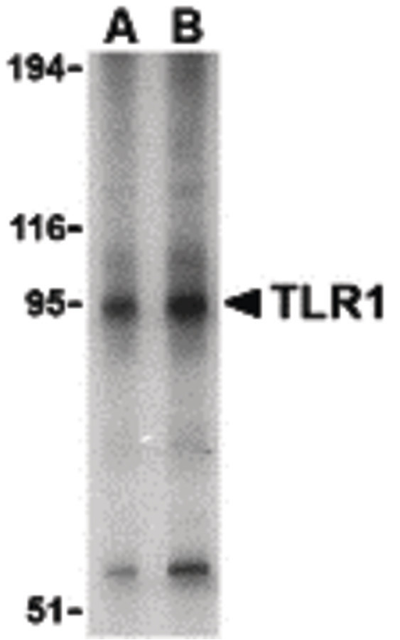 Western blot of TLR1 in Daudi cell lysate with TLR1 antibody at (A) 1 and (B) 2 ug/ml.