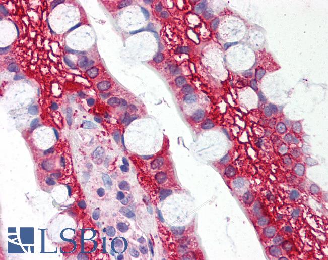 Anti-TLR1 antibody IHC of human small intestine. Immunohistochemistry of formalin-fixed, paraffin-embedded tissue after heat-induced antigen retrieval. Antibody LS-B600 concentration 5 ug/ml.
