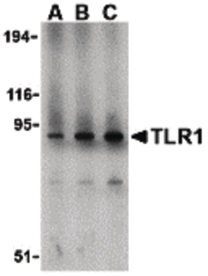 Western blot of TLR1 in mouse spleen lysate with TLR1 antibody at (A) 1, (B) 2, and (C) 4 ug/ml.