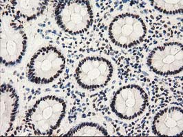 IHC of paraffin-embedded Human colon tissue using anti-PYCRL mouse monoclonal antibody.