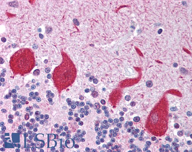 Anti-TLR10 antibody IHC of human brain, cerebellum. Immunohistochemistry of formalin-fixed, paraffin-embedded tissue after heat-induced antigen retrieval. Antibody LS-B1416 concentration 5 ug/ml.