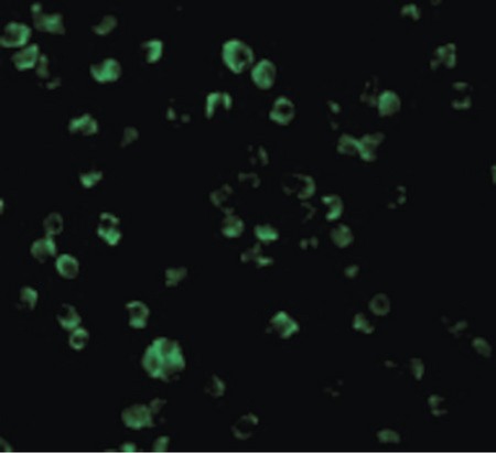 Immunofluorescence of TLR10 in Daudi cells with TLR10 antibody at 2 ug/ml.