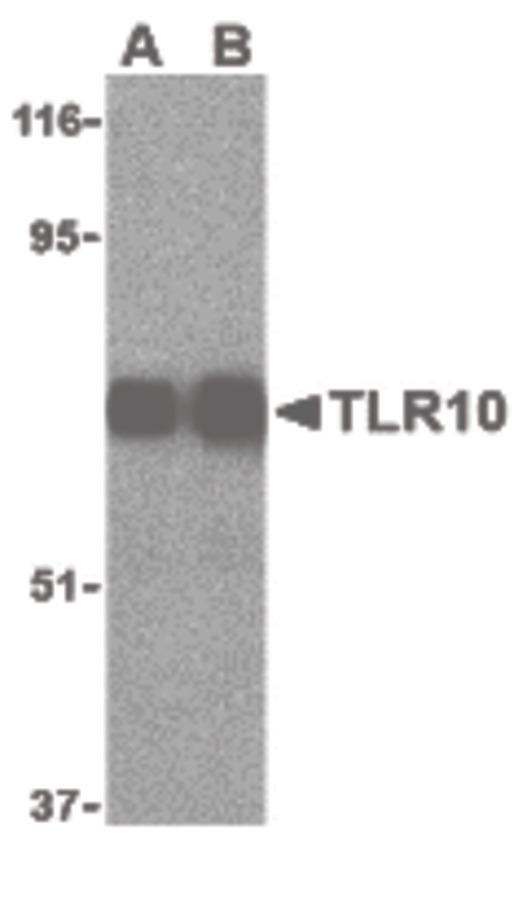 Western blot of TLR10 in human lymph node cell lysates with TLR10 antibody (IN) at (A) 0.5 and (B) 1 ug/ml.