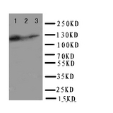WB of TLR10 antibody. Lane 1: HELA Cell Lysate. Lane 2: JURKAT Cell Lysate. Lane 3: CEM Cell Lysate.
