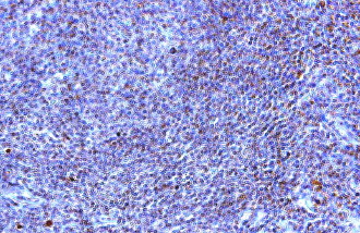 IHC of TLR10 antibody LS-C83991. Human spleen.