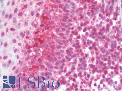Anti-TLR10 antibody IHC staining of human tonsil. Immunohistochemistry of formalin-fixed, paraffin-embedded tissue after heat-induced antigen retrieval. Antibody LS-B9935 concentration 5 ug/ml.