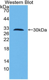 Western blot of recombinant TLR10.