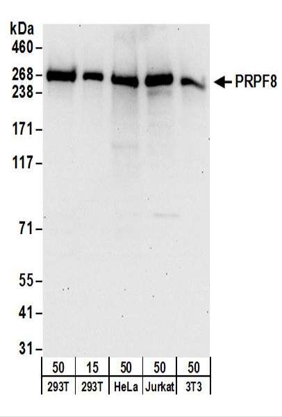 Detection of Human and Mouse PRPF8 by Western Blot. Samples: Whole cell lysate from 293T (15 and 50 ug), HeLa (50 ug), Jurkat (50 ug), and mouse NIH3T3 (50 ug) cells. Antibodies: Affinity purified rabbit anti-PRPF8 antibody used for WB at 0.1 ug/ml. Detection: Chemiluminescence with an exposure time of 30 seconds.