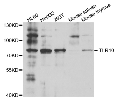 Western blot analysis of extracts of various cell lines, using TLR10 antibody.