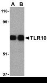 Western blot of TLR10 in human lymph node cell lysates with TLR10 antibody (IN) at (A) 0.5 and (B) 1 g/m