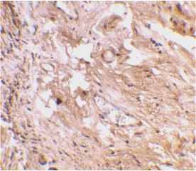 IHC of human bladder tissue using TLR11 antibody at 2 ug/ml.