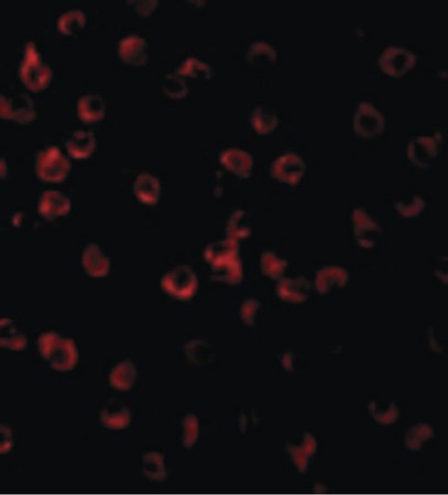 Immunofluorescence of TLR11 in Raw264.7 cells with TLR11 antibody at 10 ug/ml.