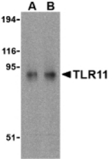 Western blot of TLR11 in RAW264.7 cell lysates with TLR11 antibody at (A) 0.5 and (B) 1 ug/ml.