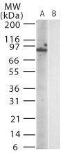 Western blot of mouse TLR12 in (A) transfected and (B) untransfected cell lysate using antibody at 1:1000.