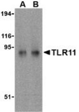 Western blot of TLR11 in RAW264.7 cell lysates with TLR11 antibody at (A) 0.5 and (B) 1 g/ml.
