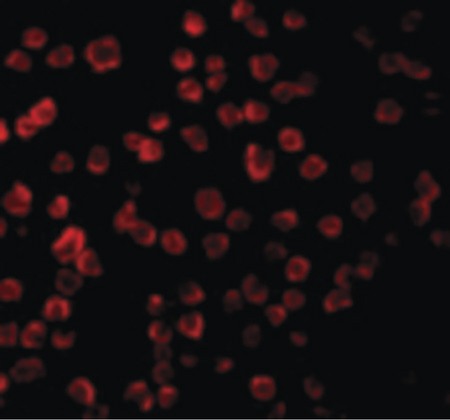 Immunofluorescence of TLR11 in Raw264 cells with TLR11 antibody at 10 ug/ml.